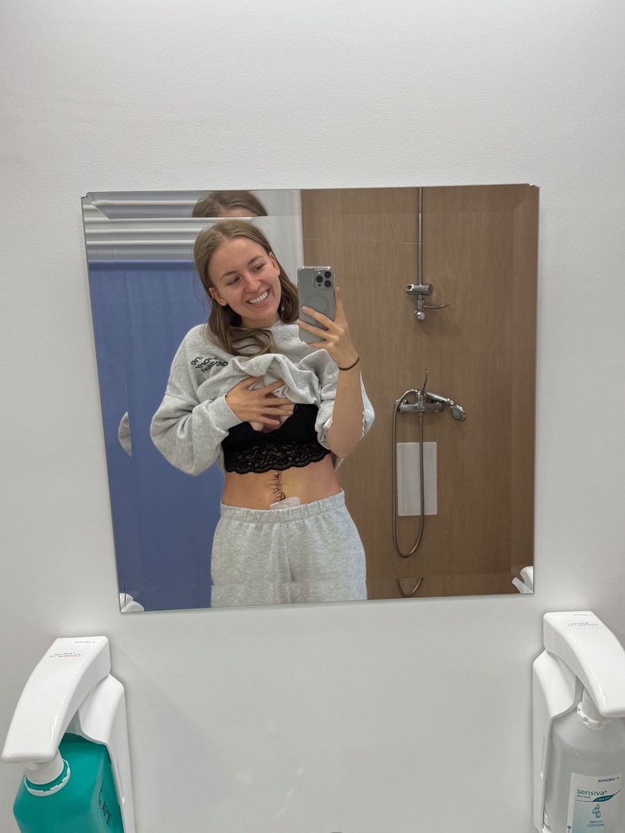 Kinga pokazuje bliznę po operacji