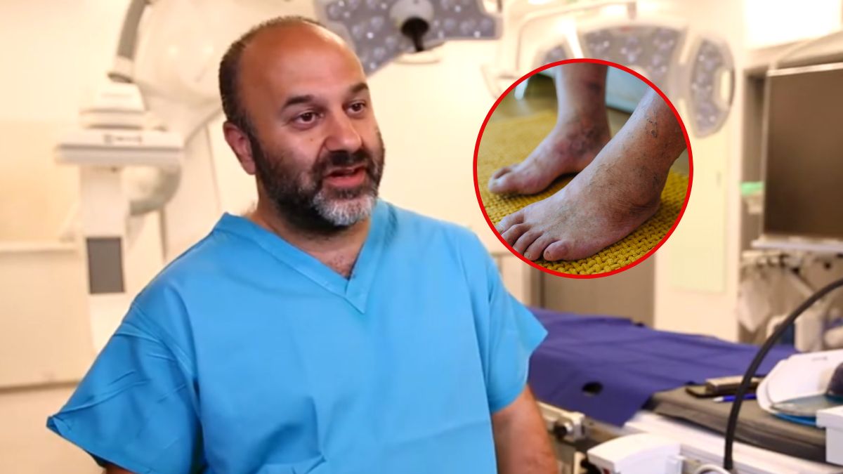 Wysoki cholesterol może prowadzić do rozwoju miażdżycy