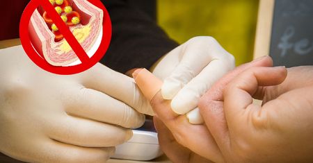 Oto nowe normy cholesterolu i lipdów. Ten poziom niesie ryzyko konsekwencji zdrowotnych
