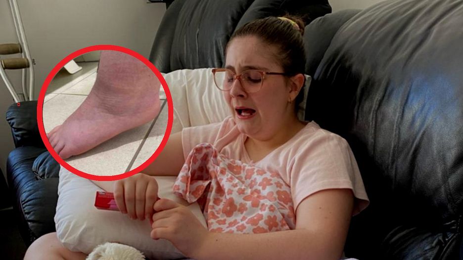 11-latka zmaga się z wyniszczającym bólem. Na jej dolegliwości nie ma lekarstwa