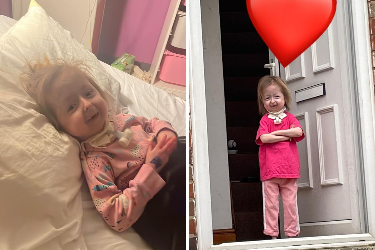 Dziewczynka cierpi na rzadkie schorzenie zwane progerią