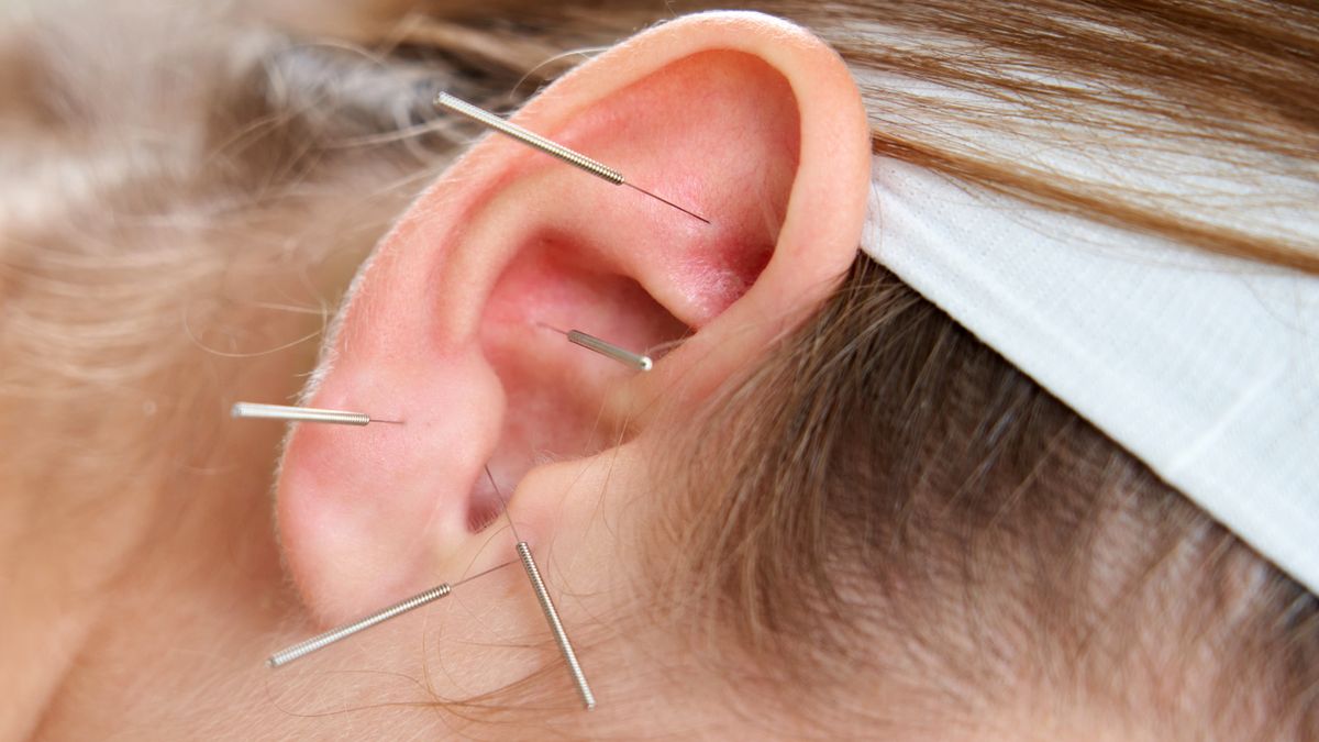 Akupunktura ucha pomaga zrzucić zbędne kilogramy