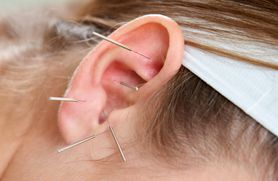 Akupunktura ucha – wskazania i przeciwwskazania. Jak przebiega procedura?