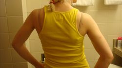 Rwa kulszowa - przyczyny, objawy, leczenie. Czym jest objaw Lasegue'a?