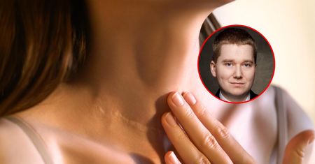 Problem ma co piąty Polak. Zamiast leków biorą jod na potęgę i piją płyn Lugola