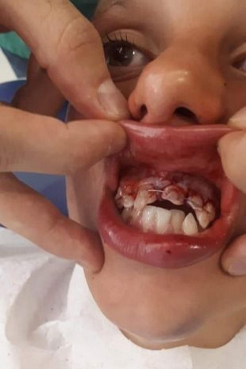 Groźny wypadek na basenie