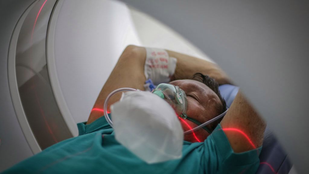 COVID-19. Jednym z możliwych powikłań jest poinfekcyjne autoimmunologiczne zapalenie mózgu