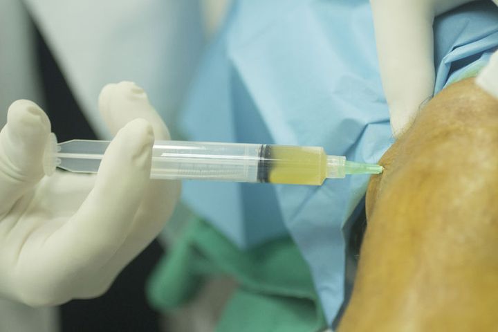 Lekarze z Brzezin wprowadzili nowatorską metodę leczenia stawu kolanowego