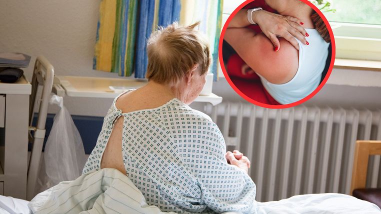 Rak płuc coraz częściej atakuje Polki. Oto powód