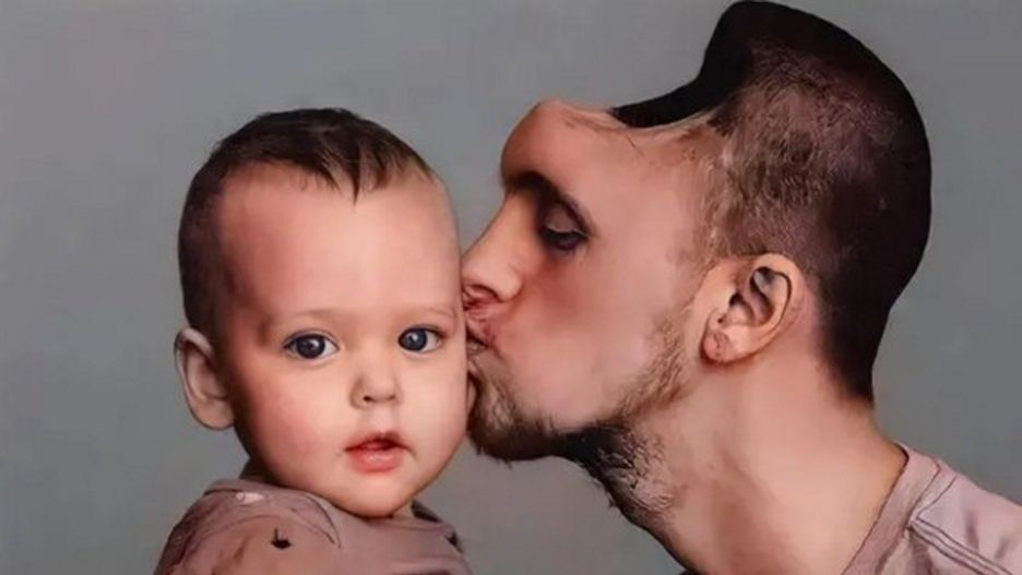 Ojciec stracił połowę czaszki. Wszystko przez napoje energetyczne