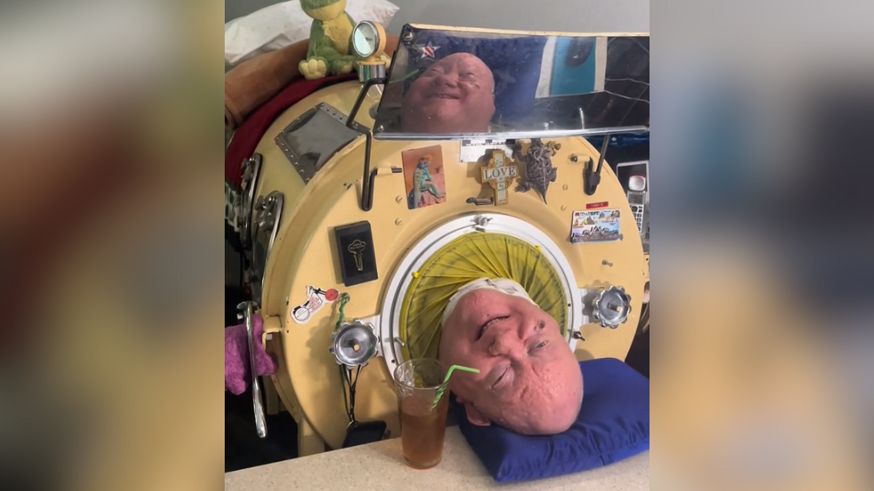 Człowiek w żelaznym płucu trafił do szpitala. Powodem jest groźna infekcja