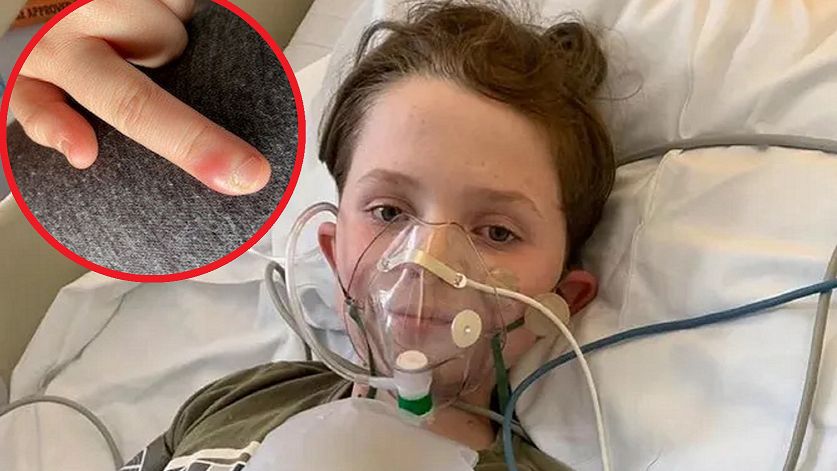 Jedynym objawem było obgryzanie paznokci. Diagnoza była szokiem