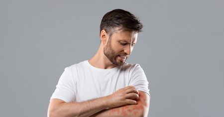 Erytrodermia – leczenie, objawy i przyczyny