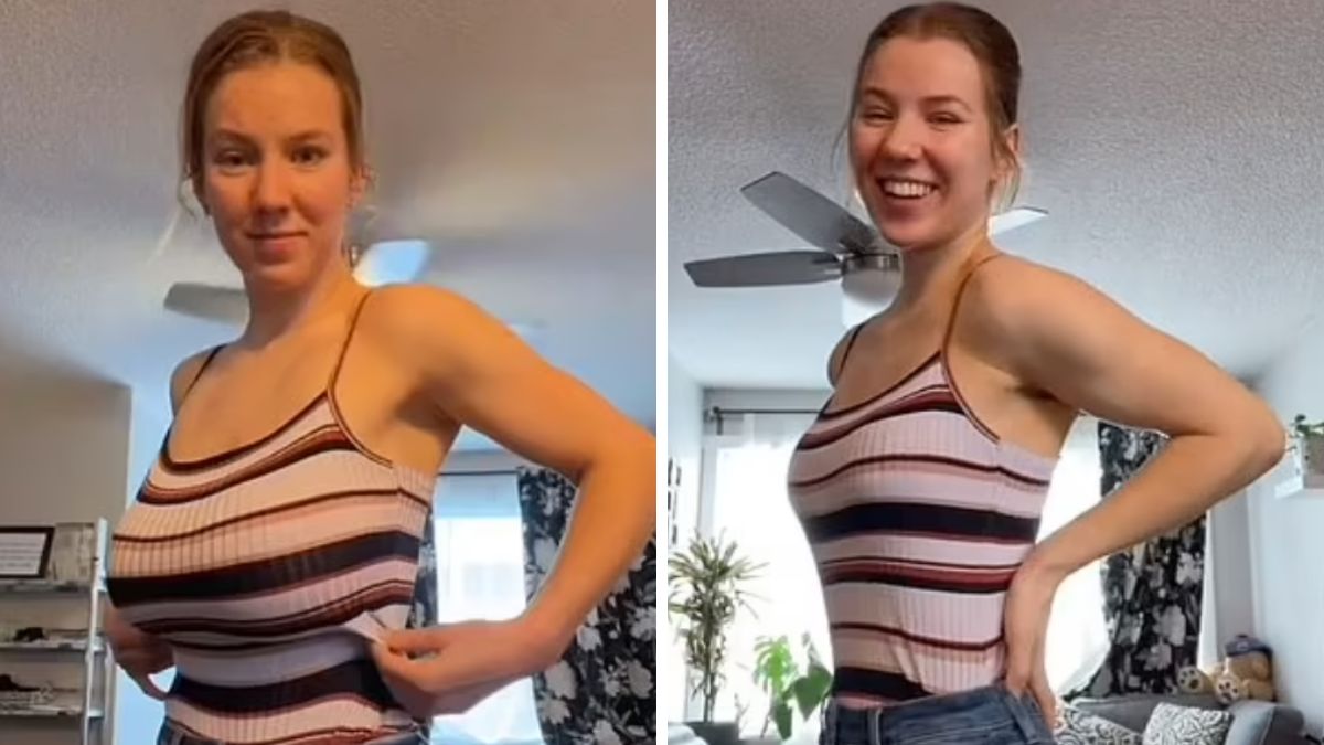 Silne migreny i ból ramion były jej codziennością. Mimo to dziesięciu lekarzy odmówiło wykonania operacji zmniejszenia piersi