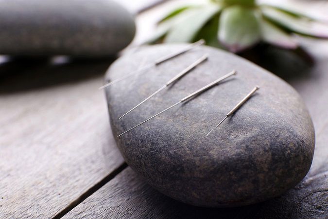Akupunktura z Chin