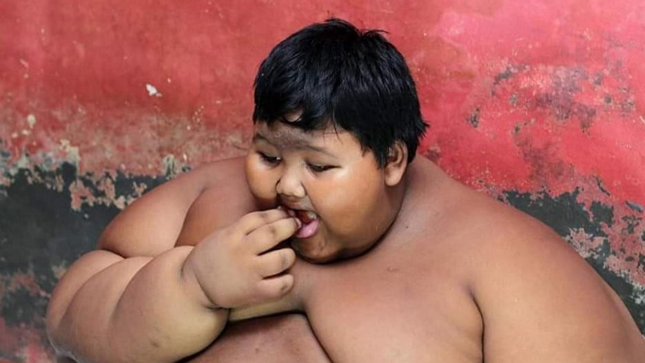 Najgrubsze dziecko na świecie przeszło ogromną metamorfozę