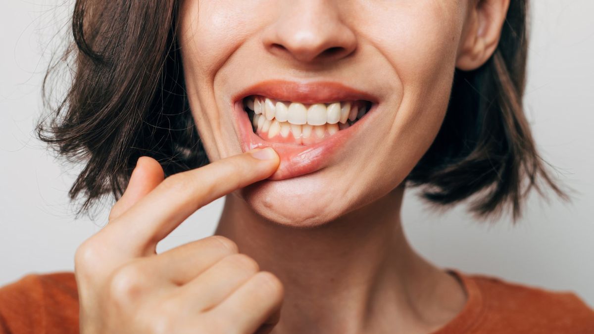 Czarna kropka w jamie ustnej może być zarówno niegroźnym krwiakiem, jak i objawem choroby nowotworowej.