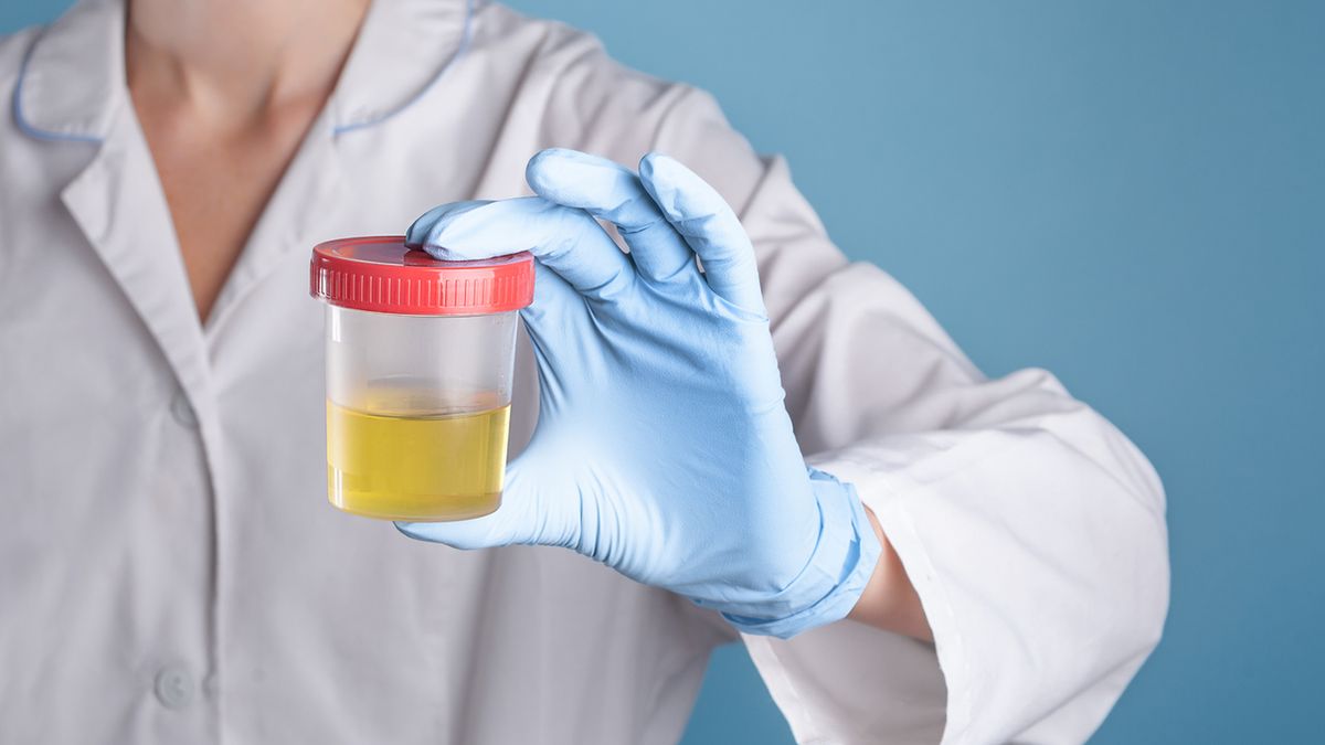 Ciała ketonowe w moczu: przyczyny