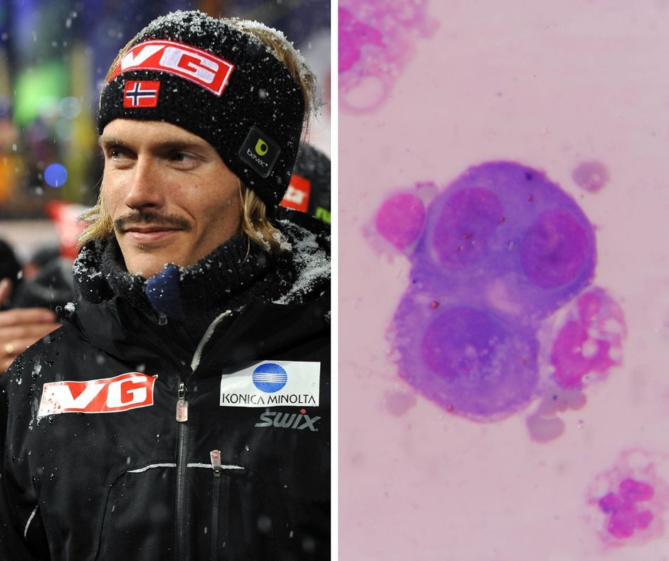 Były skoczek Bjoern Einar Romoeren walczy z nowotorem kości 