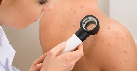 Plamica Schönleina-Henocha – charakterystyka, przyczyny, objawy, diagnoza i leczenie