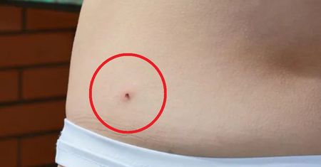 Łatwo pomylić z pieprzykiem. Skutki mogą być poważne