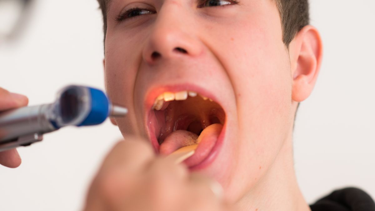 Mutacja głosu jest zjawiskiem fizjologicznym, nie wymaga leczenia