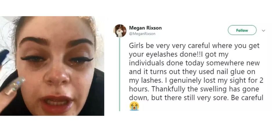 Megan Rixson straciła wzrok przez sztuczne rzęsy przyklejone klejem do paznokci. Teraz ostrzega innych