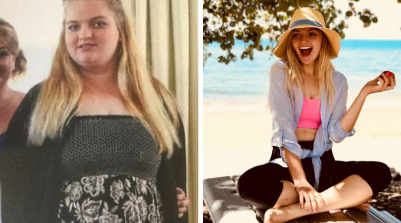 (Instagram.com) Nastolatka chciała schudnąć już kilka lat wcześniej, ale brak samozaparcia i wiary w siebie sprawiły, że według Josie jedyną opcją na utratę wagi jest dla niej operacja