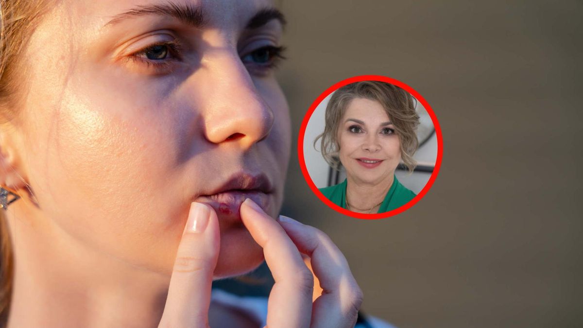 Opryszczka uaktywnia się, gdy odporność spada. Wielu lekceważy tego wirusa