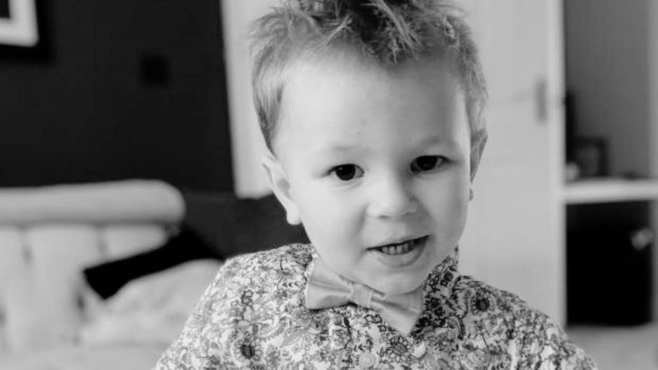 Objaw pojawił się na twarzy. Chłopiec zmarł