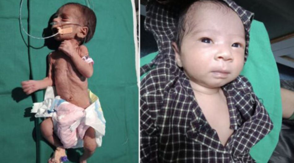 "To, że żyje to cud". W Indiach odnaleziono dziewczynkę pogrzebaną żywcem