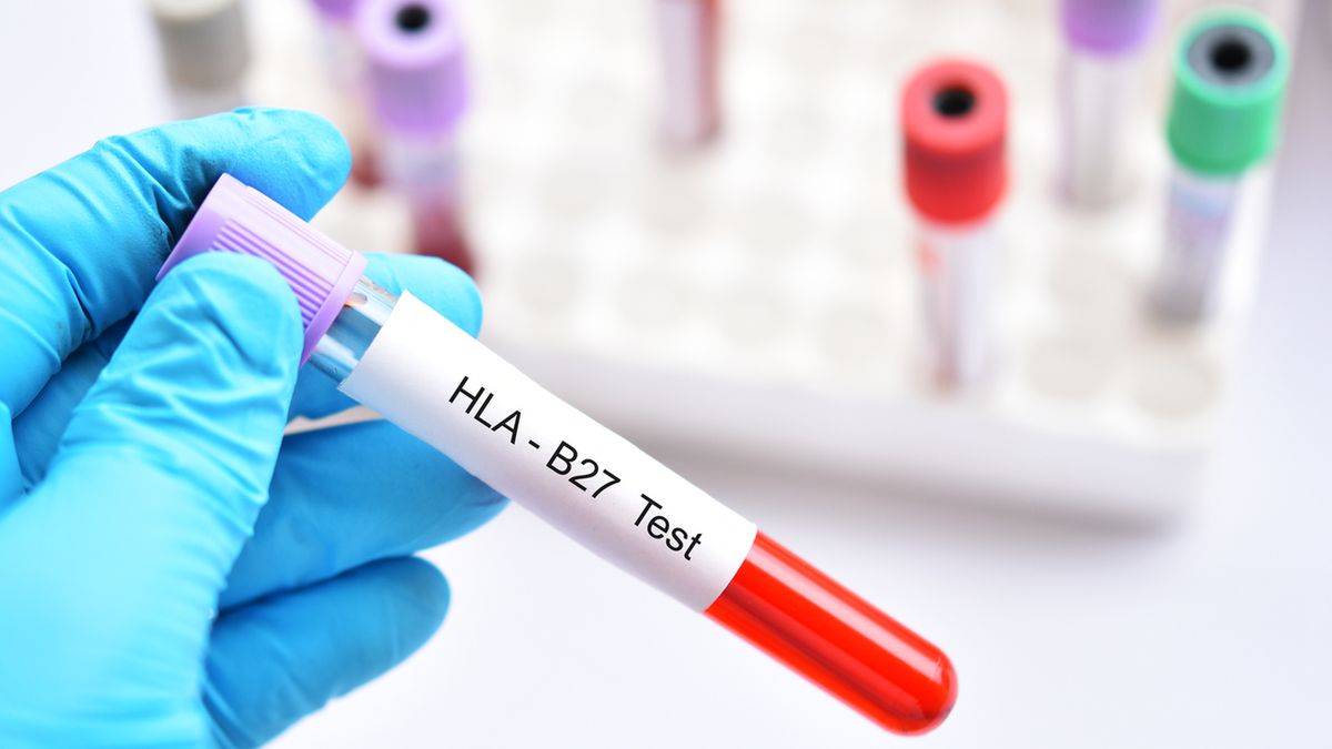 HLA-B27 to antygen, który może być związany z kilkoma chorobami autoimmunologicznymi.