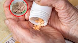 Witamina kluczowa dla mózgu. Niedobór sprzyja demencji i pogorszeniu funkcji poznawczych