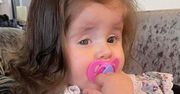 Dwuletnia dziewczynka, z powodu choroby, wyrywała sobie włosy z głowy. "Dostała obsesji na punkcie gryzienia"
