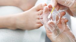 Badanie mykologiczne - infekcje grzybicze pochwy, grzybica skóry, grzybica narządowa, inne metody