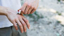 Ciągłe swędzenie skóry okazało się objawem nowotworu. Zlekceważono objawy