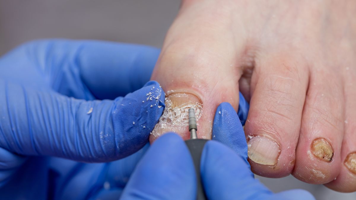 Podolog przeprowadza zabiegi lecznicze stóp