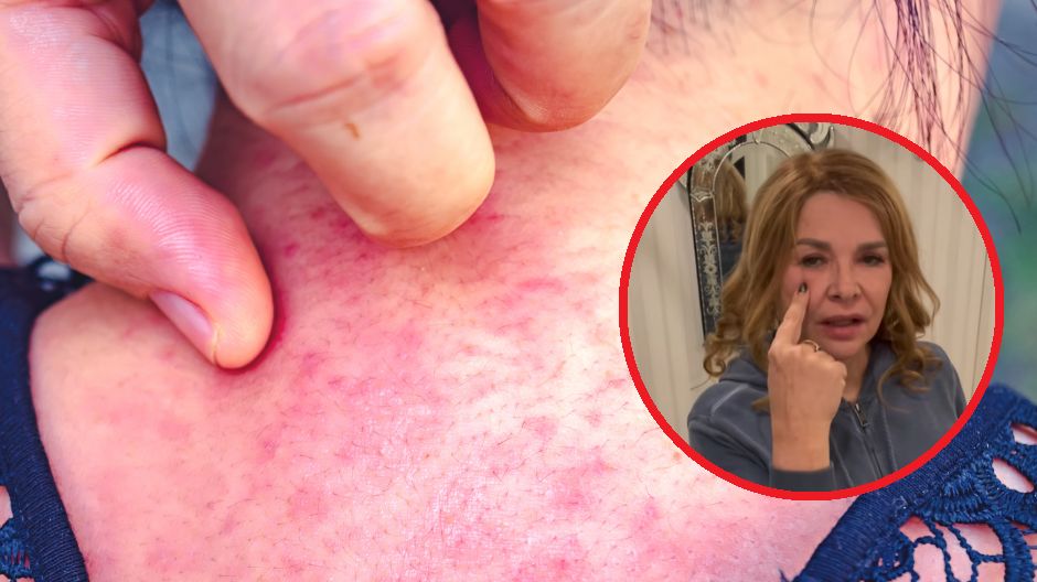 FDA publikuje listę najpowszechniejszych alergenów obecnych w kosmetykach