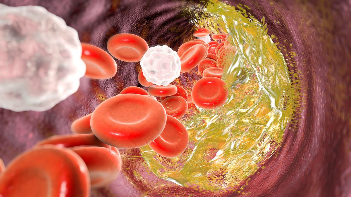 Cholesterol całkowity jest tłuszczowym związkiem chemicznym, niezbędnym do prawidłowego funkcjonowania organizmu.