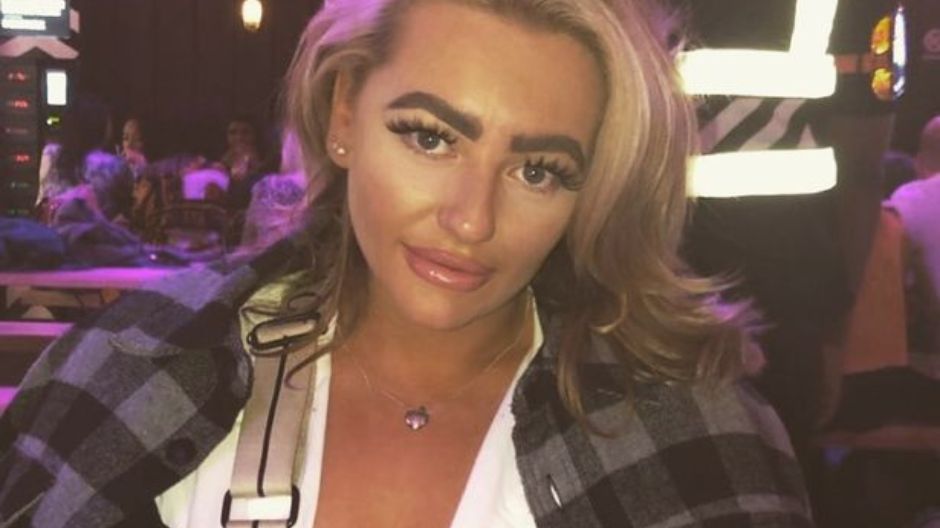 Po nieudanym zabiegu depilacji woskiem trafiła do szpitala na 3 dni. Przeżyła horror