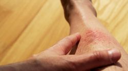 Nieoczywiste objawy chorób jelit