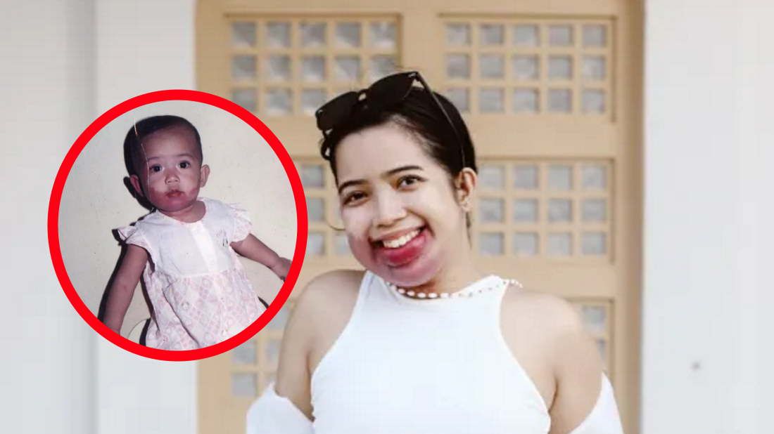 Obwinia lekarzy o problemy zdrowotne. Zupełnie zignorowali problem, gdy była dzieckiem