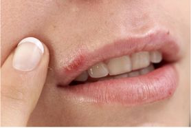 Groźny niedobór selenu