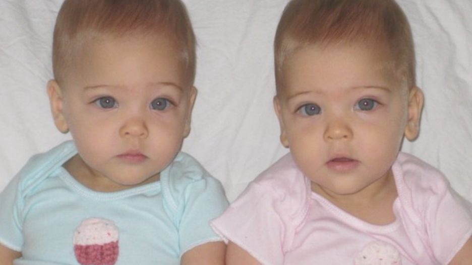 Jak wyglądają dziś najpiękniejsze bliźniaczki na świecie?