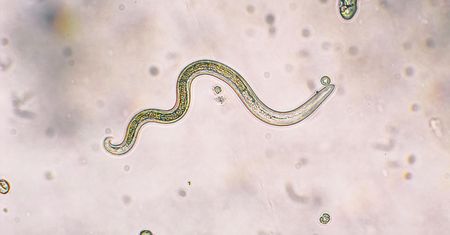 Toksokaroza - charakterystyka, rodzaje, objawy, diagnostyka, przeciwciała IgG, leczenie, profilaktyka
