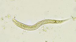 Objawy owsików  - zarażanie