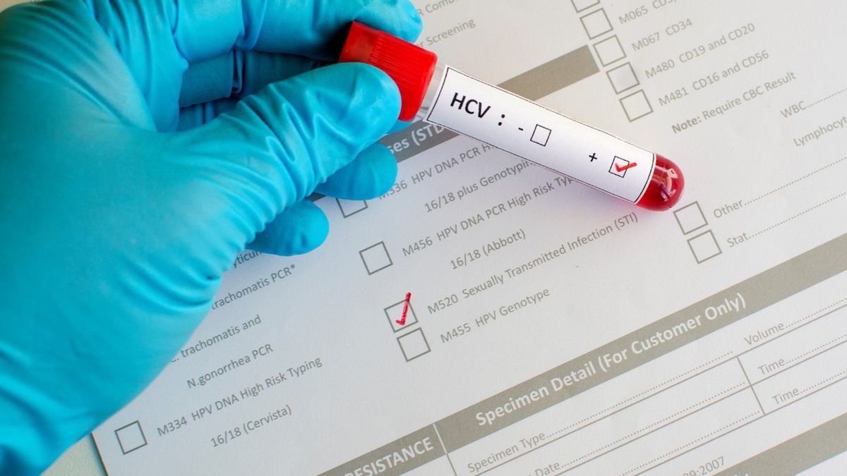 WZW C (wirusowe zapalenie wątroby typu C) - drogi zarażenia, przebieg i objawy, leczenie