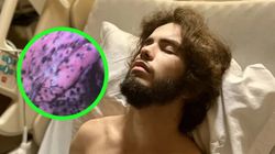 Najpierw czarne plamy, potem płuco się rozpadło. Lekarze wskazali winowajcę