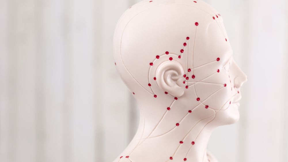 Jak działa akupunktura?