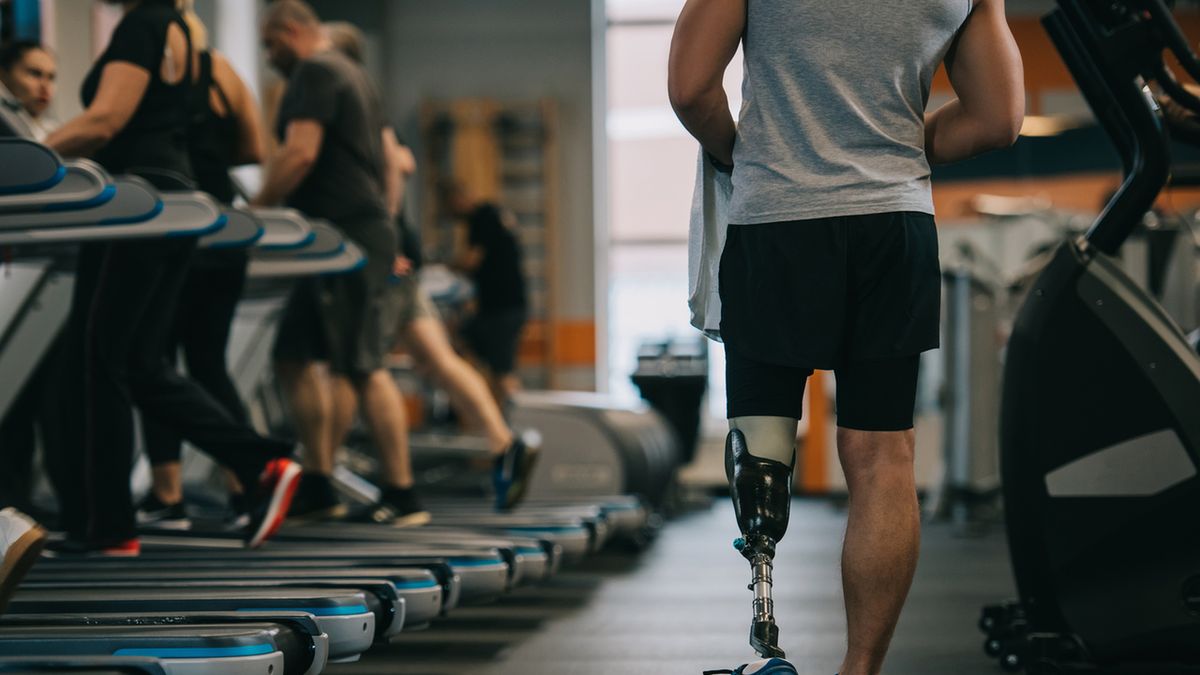 Hemimelia (wrodzona amputacja kończyn) to bardzo rzadka wada wrodzona.